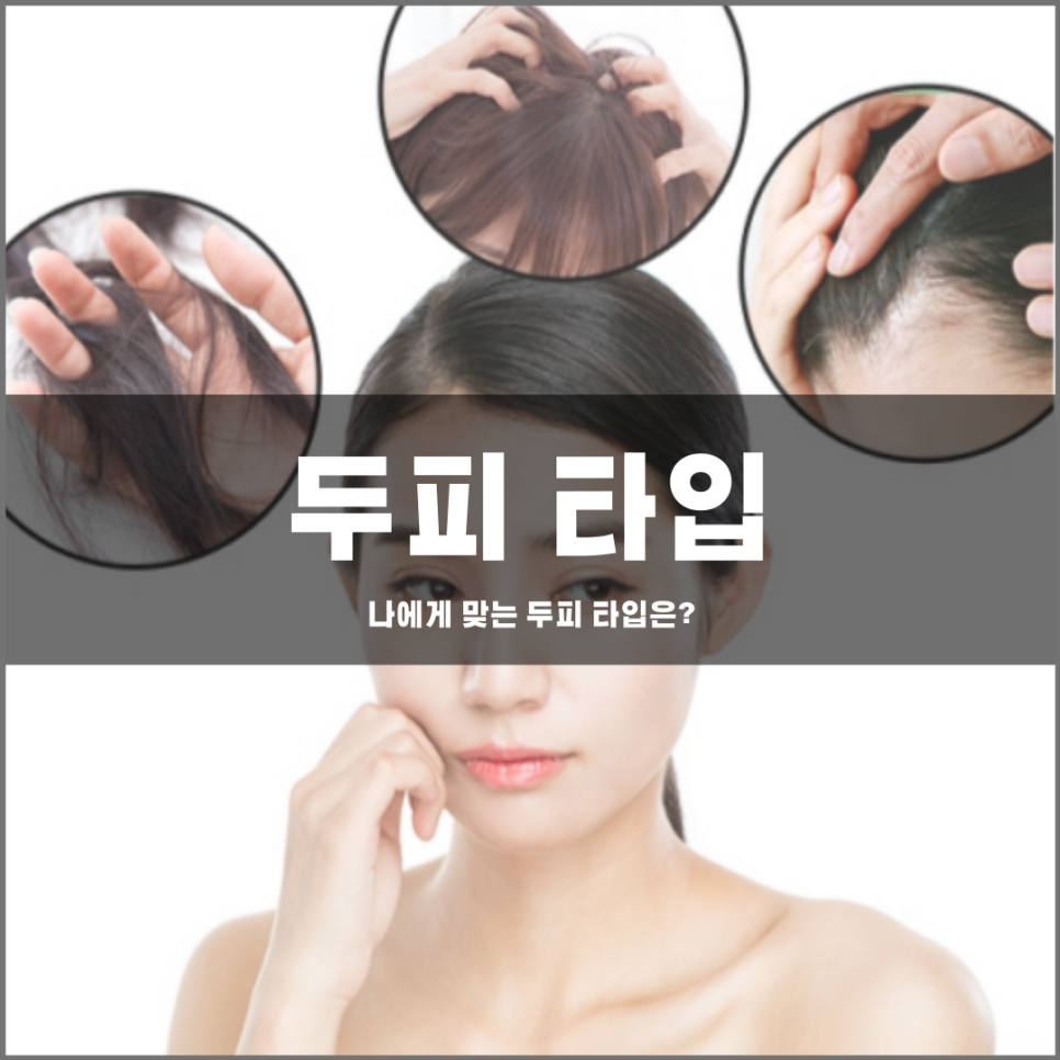 나에 딱맞는 두피 타입은 어떻게 알수 있을까?