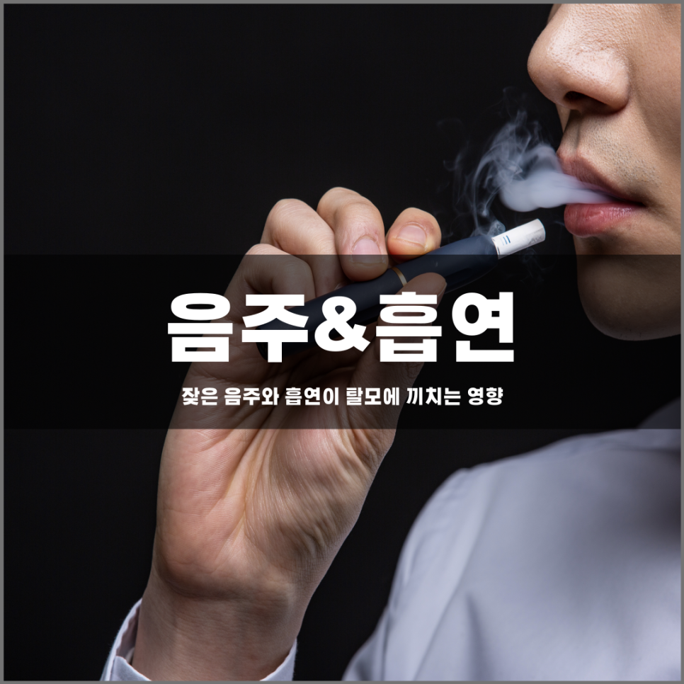 흡연과 음주과 탈모에 미치는 영향은?